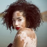 Profile picture of Vitiligo Natural Treatment